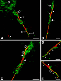 image of myelin contacts as submitted to the Journal of Neuropathology & Experimental Neurology