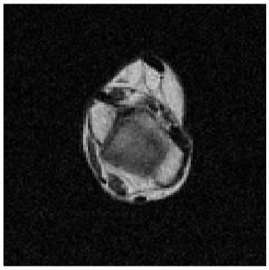 MR MATERIALISE KNEE AXIAL IMAGE FOR MRI TECHS