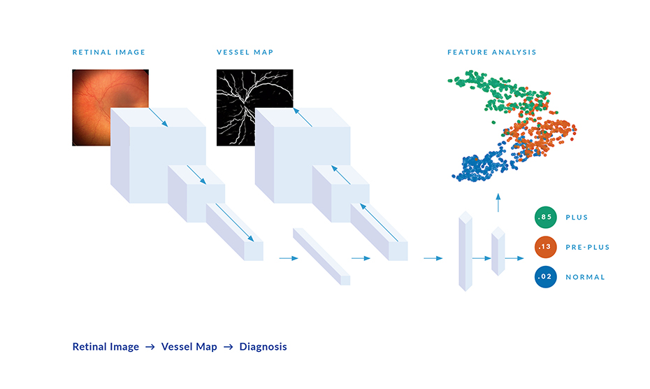 An artificial intelligence app created to diagnose a common blinding eye disease in preemies