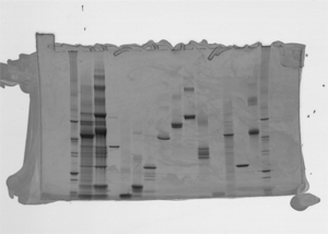 Protein gel