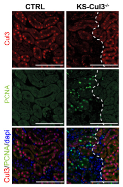 CUL3 injury figure control vs KS-Cul3 KO