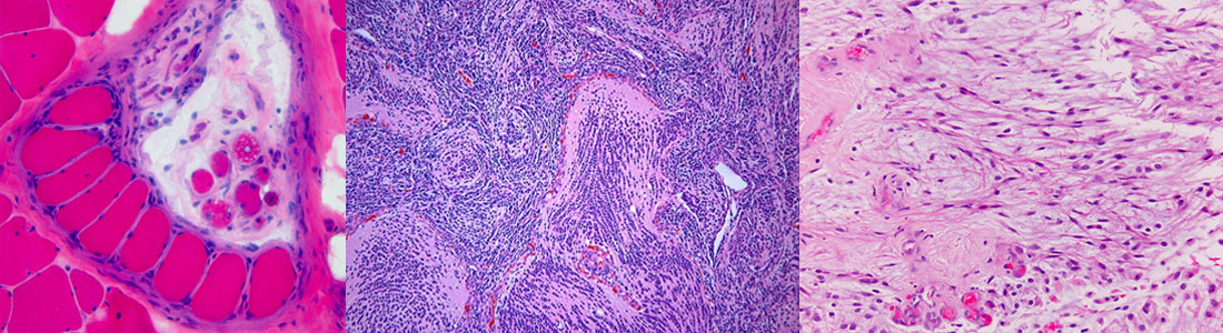 Neuropathology Services