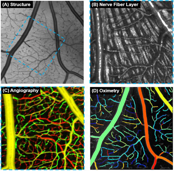 New eye imaging technology captures blood oxygen saturation in retinal capillaries.