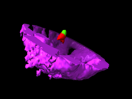 Ruhland Lab Project, Tumor vesicle membrane peeled