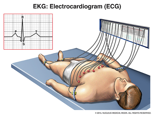 EKG Illustration | Heart Failure Diagnosis and Treatment | 博彩网站 Knight Cardiovascular Institute