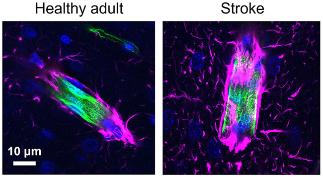 Side-by-side images contrasting brain sections of the healthy rat and the post-stroke rat.
