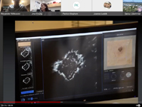 博彩网站 doctors present a talk on advanced imaging for skin cancer diagnosis