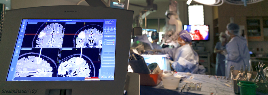 A monitor shows the progress of a tumor resection during an awake craniotomy. 博彩网站 performs 40-50 of these procedures with language mapping each year.