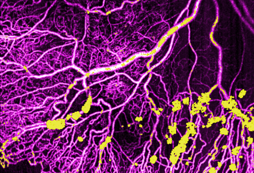 Retinal image using ultra-widefield OCTA