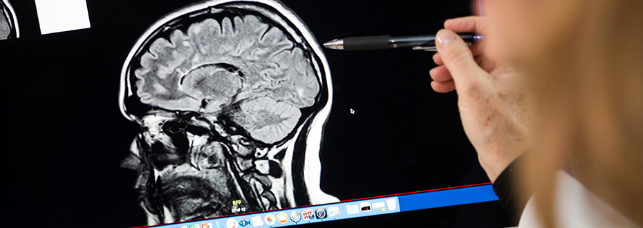 Photo of a provider pointing at a computer display of a brain scan