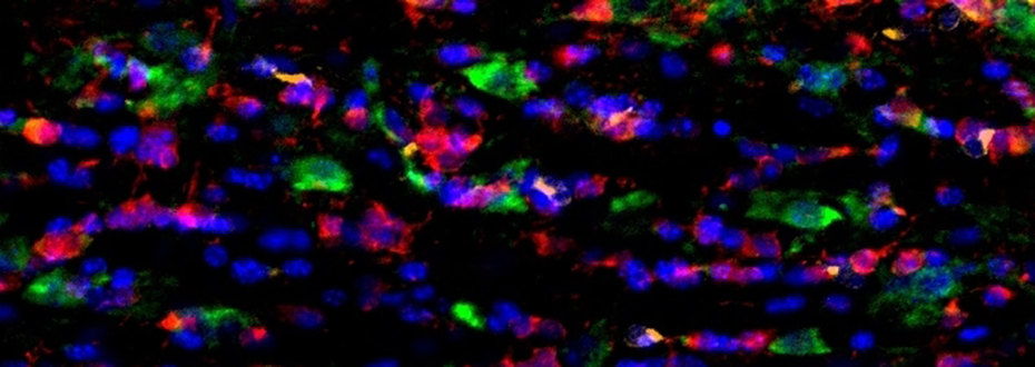 A colorful section of the corpus callosum.
