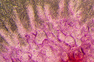 color slide of digit/joint formation