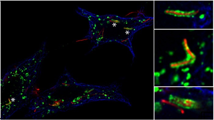 image showing microscopy experiment with Mtb inside cells