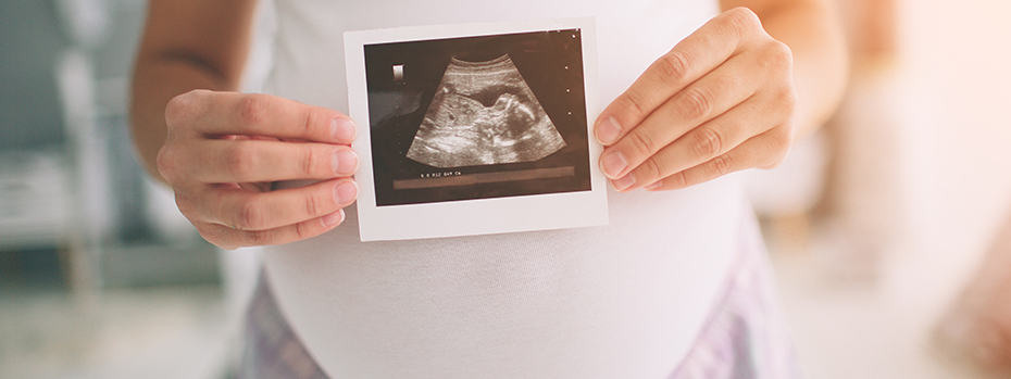 A close-up of an ultrasound image held by a pregnant person.