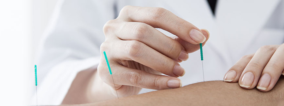A practitioner applying acupuncture treatment to a patient.