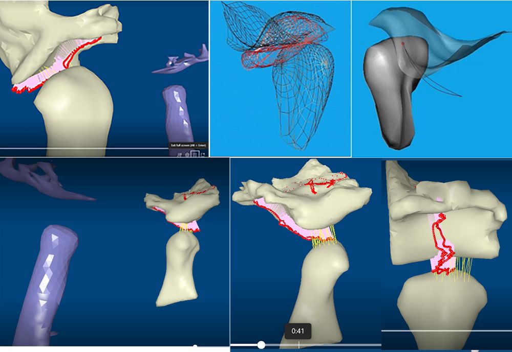 6 images of TMJ mechanics