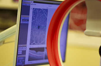 A computer monitor in the background displays results from imaging technology known as optical coherence tomography while the orange edge of the scanning device appears in the foreground.