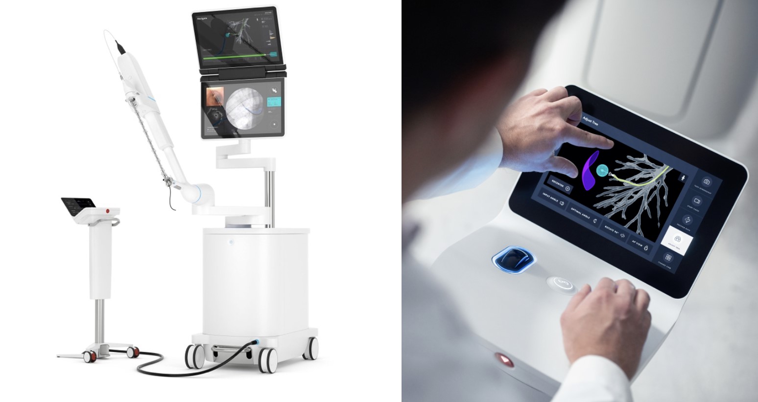 Photograph of Ion Robot used in Interventional Pulmonology Procedures