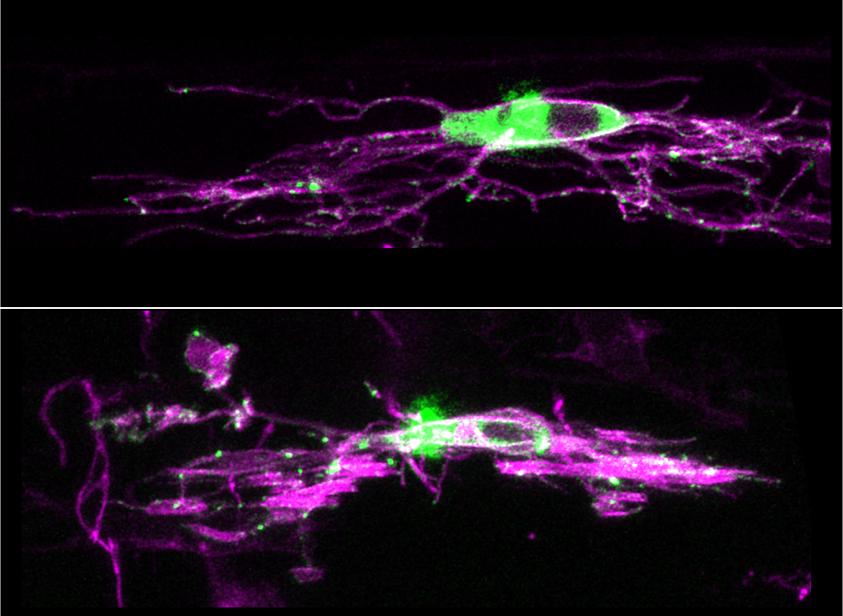 Synapses This image shows synapses across development of oligodendrocyte precursor cells: OPC (top), and myelinating oligodendrocyte (bottom). Magenta labels the morphology of the cell processes and the green labels synapses. (Contributed)