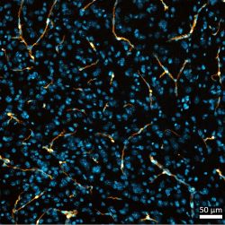 Pericytes (orange) decorating the cortex. DAPI-labeled nuclei are in blue.