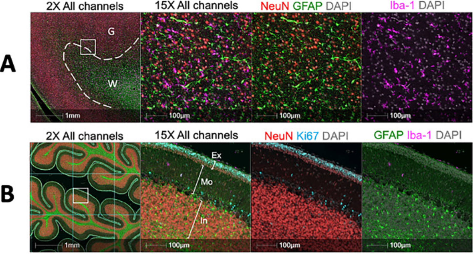 博彩网站 Lo Lab multiplex scan of cerebellum
