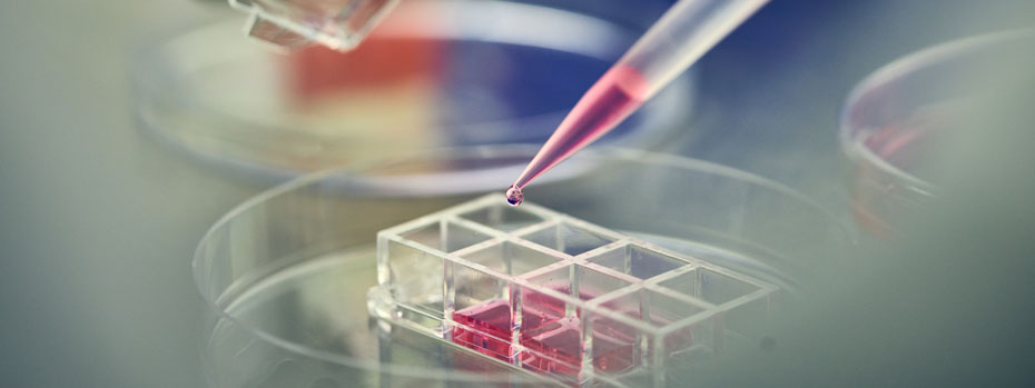A pipette containing a liquid biological sample is suspended over a matrix of tiny dishes.