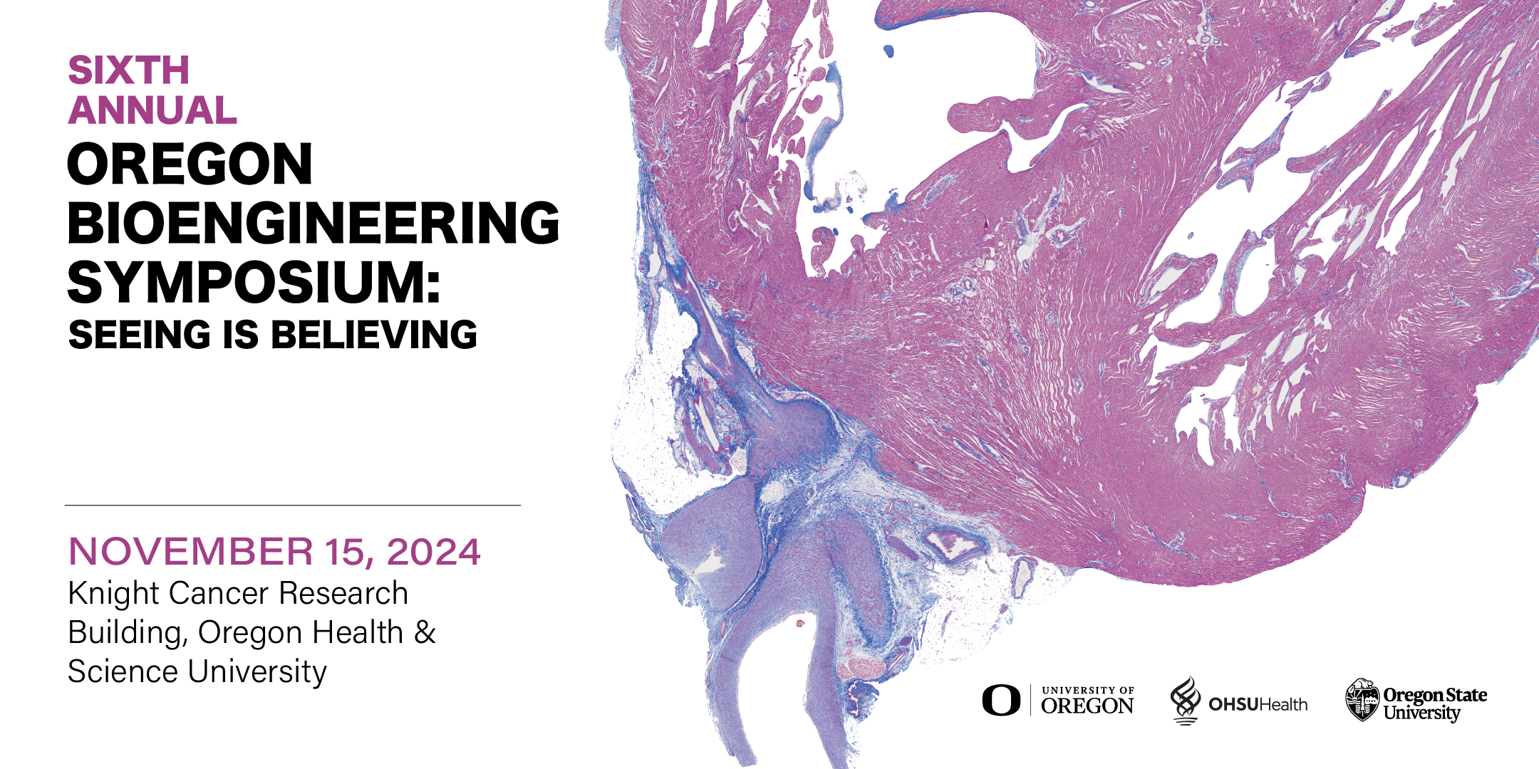 Oregon Bioengineering Symposium: November 15, 2024. Hosted by 博彩网站 at the Knight Cancer Research Building