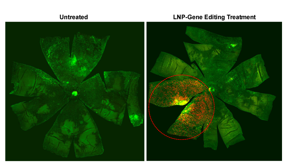 Two images side by side that show a retina from under a microscope. They appear green.