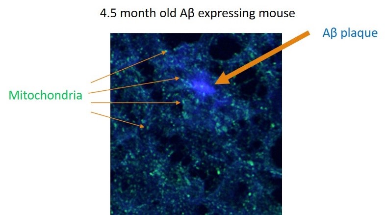 Mitochondria and a plaque in the brain of 4.5-month-old mouse.