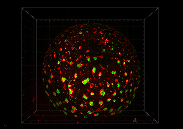 A microscopic image showing a round adipocyte cell with dozens of green spots (fatty acid) outlined in red (mitochondria) on a black background.